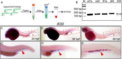 Ifi30 Is Required for Sprouting Angiogenesis During Caudal Vein Plexus Formation in Zebrafish